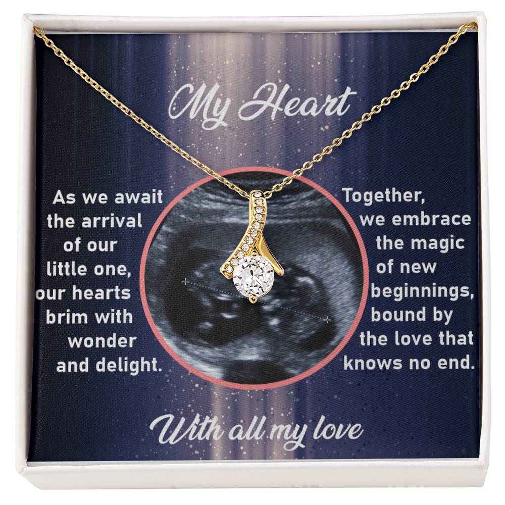 Ultrasound Image, Baby Announcement, Pregnancy Announcement, Ultrasound Picture, Ultrasound Photo, Pregnancy Reveal, Coming Soon