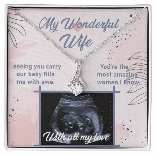 Ultrasound Image, Pregnancy Reveal, Baby Announcement, Pregnancy Announcement, Ultrasound Picture, Ultrasound Photo, Coming Soon